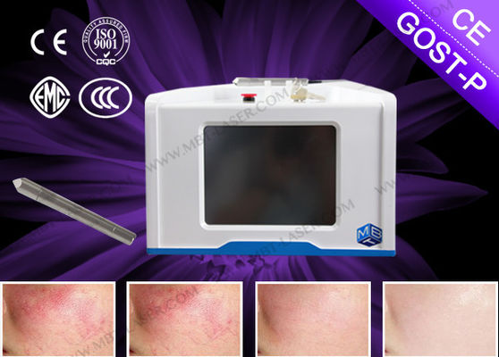 Machine de retrait de veine de laser de promotion, peau serrant l'équipement